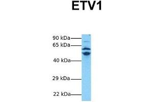 Western Blotting (WB) image for anti-Ets Variant 1 (ETV1) (Middle Region) antibody (ABIN2780627)