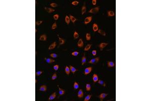 Immunofluorescence analysis of L929 cells using PPP1R9B antibody (ABIN7269681) at dilution of 1:100. (PPP1R9B 抗体)