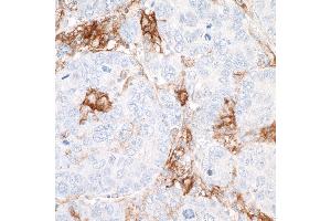 Immunohistochemistry (IHC) image for anti-CD40 (CD40) (AA 227-277) antibody (ABIN7454023) (Recombinant CD40 抗体  (AA 227-277))
