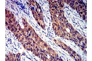 Immunohistochemistry (IHC) image for anti-Sema Domain, Immunoglobulin Domain (Ig), Transmembrane Domain (TM) and Short Cytoplasmic Domain, (Semaphorin) 4D (SEMA4D) (AA 590-734) antibody (ABIN5611304)