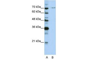 WB Suggested Anti-PRPF3 Antibody Titration:  0. (PRPF3 抗体  (N-Term))