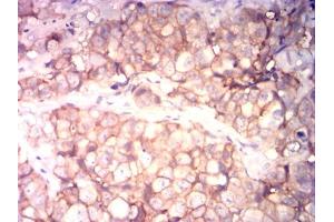 Immunohistochemistry (IHC) image for anti-CD99 (CD99) (AA 1-185) antibody (ABIN7193657)