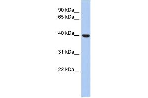 WB Suggested Anti-STOML3 Antibody Titration: 0. (STOML3 抗体  (N-Term))