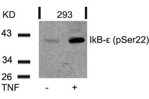 Western blot analysis of extracts from 293 cells untreated or treated with TNF using IkB-e(Phospho-Ser22) Antibody.
