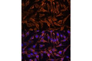Immunofluorescence analysis of L929 cells using TNFRSF11A Polyclonal Antibody (ABIN6127588, ABIN6149309, ABIN6149311 and ABIN6216817) at dilution of 1:100 (40x lens). (TNFRSF11A 抗体  (AA 466-616))