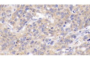 Immunohistochemistry (IHC) image for anti-B-Cell CLL/lymphoma 2 (BCL2) (AA 2-211) antibody (ABIN7426028)