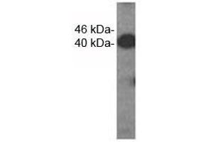 Western analysis of extracts from HDMEC cells using VEGFC antibody. (VEGFC 抗体)