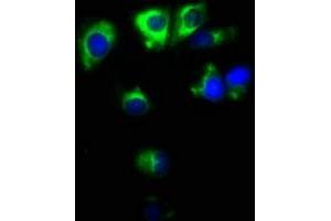 Immunofluorescence staining of MCF-7 cells with ABIN7171138 at 1:100, counter-stained with DAPI. (Synaptoporin 抗体  (AA 199-265))