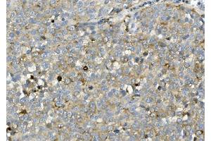 IHC analysis of ASAH1 using anti-ASAH1 antibody (ABIN7602206). (ASAH1 抗体  (AA 63-393))