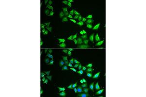 Immunofluorescence analysis of U2OS cells using CCBL1 antibody. (CCBL1 抗体  (AA 1-270))