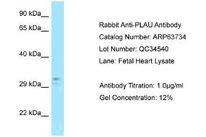 Western Blotting (WB) image for anti-Plasminogen Activator, Urokinase (PLAU) (C-Term) antibody (ABIN2789605) (PLAU 抗体  (C-Term))