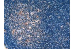 IHC-P analysis of Mouse Lymph Node Tissue, with DAB staining. (Galectin 9 抗体  (AA 225-353))