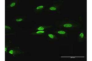 Immunofluorescence of purified MaxPab antibody to PAX2 on HeLa cell. (PAX2A 抗体  (AA 1-431))