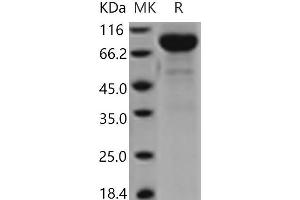 Western Blotting (WB) image for Interleukin 13 Receptor, alpha 2 (IL13RA2) (Active) protein (Fc Tag) (ABIN7196400) (IL13RA2 Protein (Fc Tag))