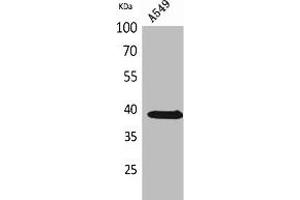 Western Blotting (WB) image for anti-Solute Carrier Family 1 (Neuronal/epithelial High Affinity Glutamate Transporter, System Xag), Member 1 (SLC1A1) (C-Term) antibody (ABIN7185247)