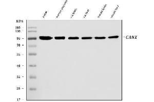 Western blot analysis of Calnexin/CANX using anti-Calnexin/CANX antibody (ABIN7602289). (Calnexin 抗体  (AA 68-582))