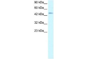 CCR8 antibody (20R-1321) used at 5 ug/ml to detect target protein. (CCR8 抗体  (Middle Region))