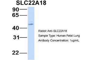 Host:  Rabbit  Target Name:  SLC22A18  Sample Type:  Human Fetal Lung  Antibody Dilution:  1. (ORCTL-2/SLC22A18 抗体  (N-Term))
