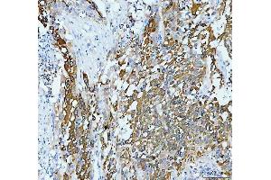 IHC analysis of AGR2 using anti-AGR2 antibody (ABIN5518726).