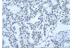Immunohistochemistry (IHC) image for anti-Heterogeneous Nuclear Ribonucleoprotein H3 (2H9) (HNRNPH3) (N-Term) antibody (ABIN2779031)