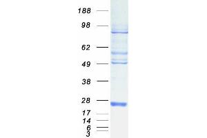 Western Blotting (WB) image for Destrin (Actin Depolymerizing Factor) (DSTN) (Transcript Variant 1) protein (Myc-DYKDDDDK Tag) (ABIN2719428)
