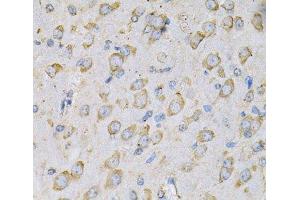 Immunohistochemistry of paraffin-embedded Rat brain using IL10RA Polyclonal Antibody at dilution of 1:100 (40x lens). (IL-10RA 抗体)
