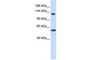 Image no. 1 for anti-Inhibin Binding Protein (INHBP) (C-Term) antibody (ABIN6743082) (IGSF1 抗体  (C-Term))