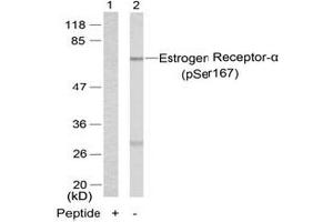 Image no. 3 for anti-Estrogen Receptor 1 (ESR1) (pSer167) antibody (ABIN196745) (Estrogen Receptor alpha 抗体  (pSer167))