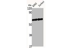 Western Blot analysis of K562 Jurkat cells using SNM1B Polyclonal Antibody (DCLRE1B 抗体  (C-Term))