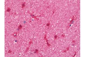 Immunohistochemistry (IHC) image for anti-Syntrophin, alpha 1 (Dystrophin-Associated Protein A1, 59kDa, Acidic Component) (SNTA1) (AA 191-505) antibody (ABIN1937046)