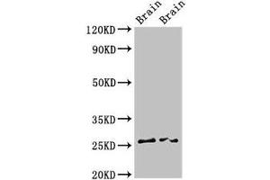 Western Blot Positive WB detected in: Rat brain tissue, Mouse brain tissue All lanes: FAM3B antibody at 3 μg/mL Secondary Goat polyclonal to rabbit IgG at 1/50000 dilution Predicted band size: 26, 31, 21 kDa Observed band size: 26 kDa (FAM3B 抗体  (AA 31-235))