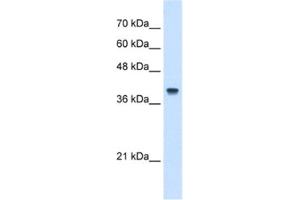 Western Blotting (WB) image for anti-Interferon-Induced Protein 44-Like (IFI44L) antibody (ABIN2462952) (IFI44L 抗体)
