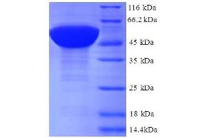 Ribosomal Protein L17 (RPL17) (AA 2-184), (full length) protein (GST tag) (RPL17 Protein (AA 2-184, full length) (GST tag))