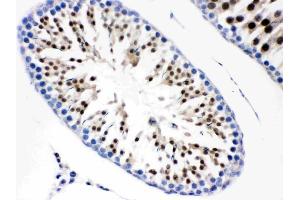IHC analysis of Cdc6 using anti-Cdc6 antibody (ABIN3043500).