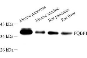 Western blot analysis of PQBP1 (ABIN7075126) at dilution of 1: 1000 (PQBP1 抗体)
