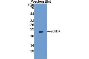Western Blotting (WB) image for anti-Peptidylprolyl Cis/trans Isomerase, NIMA-Interacting 1 (PIN1) (AA 2-165) antibody (ABIN1078430) (PIN1 抗体  (AA 2-165))