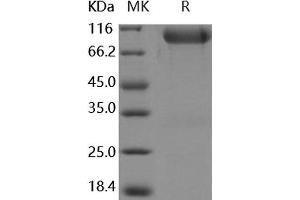 Western Blotting (WB) image for Fibroblast Growth Factor Receptor 3 (FGFR3) protein (Fc Tag) (ABIN7195777) (FGFR3 Protein (Fc Tag))