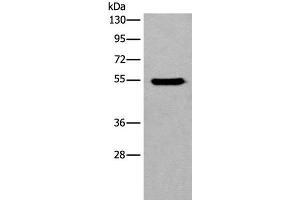 Western blot analysis of HEPG2 cell lysate using CYP11B2 Polyclonal Antibody at dilution of 1:650 (CYP11B2 抗体)