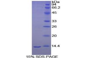 SDS-PAGE analysis of Goat Melatonin Receptor 1A Protein. (Melatonin Receptor 1A Protein (MTNR1A))