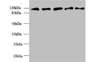 Western blot All lanes: MORC2 antibody at 6 μg/mL Lane 1: U87 whole cell lysate Lane 2: U251 whole cell lysate Lane 3: Jurkat whole cell lysate Lane 4: Hela whole cell lysate Lane 5: MCF-7 whole cell lysate Secondary Goat polyclonal to rabbit IgG at 1/10000 dilution Predicted band size: 118, 111 kDa Observed band size: 118 kDa (MORC2 抗体  (AA 2-300))