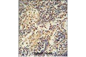 HEMK1 antibody (C-term) (ABIN654963 and ABIN2844602) immunohistochemistry analysis in formalin fixed and paraffin embedded human lymph node followed by peroxidase conjugation of the secondary antibody and DAB staining.