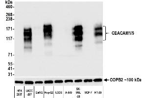 Western Blotting (WB) image for anti-Carcinoembryonic Antigen-Related Cell Adhesion Molecule 1/5 (CEACAM1/5) (AA 35-433) antibody (ABIN7455139) (Recombinant CEACAM1/5 抗体  (AA 35-433))