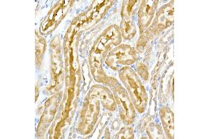 Immunohistochemistry of paraffin-embedded rat kidney using DENN Rabbit mAb (ABIN7268396) at dilution of 1:50 (40x lens). (MADD 抗体)