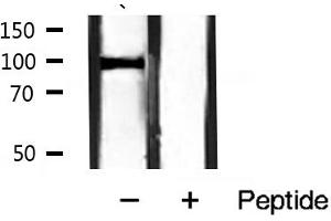 Western blot analysis of Catenin α1 expression in mouse muscle tissue lysates,The lane on the right is treated with the antigen-specific peptide. (CTNNA1 抗体  (C-Term))