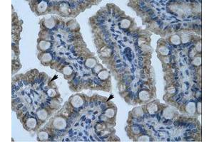 Image no. 1 for anti-Zinc Finger Protein 461 (ZNF461) (AA 26-75) antibody (ABIN203139) (ZNF461 抗体  (AA 26-75))