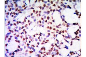 Immunohistochemical analysis of paraffin-embedded human kidney tissue using PP32 mouse mAb with DAB staining. (PHAP1 抗体)
