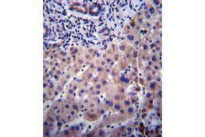 Immunohistochemistry (IHC) image for anti-Cytochrome P450, Family 3, Subfamily A, Polypeptide 4 (CYP3A4) antibody (ABIN2897882) (CYP3A4 抗体)
