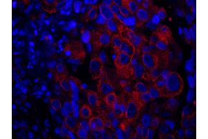 Immunofluorescence (IF) image for anti-SAM and SH3 Domain Containing 1 (SASH1) (AA 750-800) antibody (ABIN7449021) (SASH1 抗体  (AA 750-800))