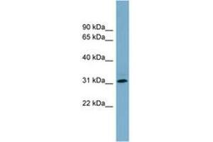 Image no. 1 for anti-Ring Finger Protein 144B (RNF144B) (AA 215-264) antibody (ABIN6743180) (RNF144B 抗体  (AA 215-264))