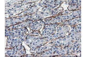 Image no. 1 for anti-Low Density Lipoprotein Receptor Adaptor Protein 1 (LDLRAP1) antibody (ABIN1496691) (LDLRAP1 抗体)